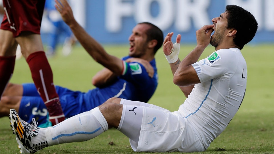 Luis Suarez hält sich die Zähne nachdem er damit in die Schulter von Italiens Giogio Chiellini gelaufen ist.